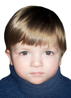 Кавказький вузол, дима Аюпов, 3 роки, симптоматична фокальна епілепсія, дегенеративне