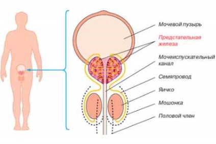 Cancer Treatment szóda minden szakaszában metasztázis