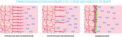 Лікування циститу в Краснодарі, клініка урогінекології і нейроурології