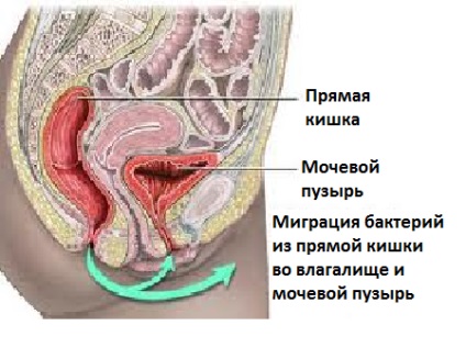 Tratamentul cistitei la Krasnodar, o clinică de urogeologie și neurologie