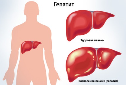 Лікування вірусного гепатиту в китаї