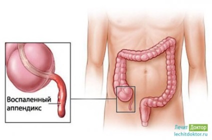 Tratează doctorul! Site despre sănătate, boli, metode de diagnosticare și tratament