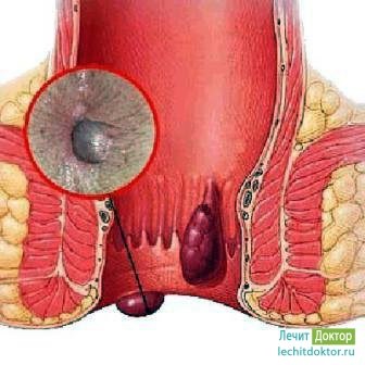 Tratează doctorul! Site despre sănătate, boli, metode de diagnosticare și tratament