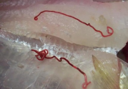 Ligulosis hal veszélyt az emberre, típusai, kezelése és tünetei férgek és egyéb paraziták