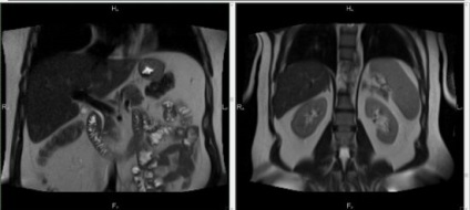 Mirtul cavității abdominale care arată și ce organe sunt verificate