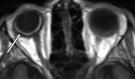 MRI szakértő MRI betegségek diagnosztizálására a pályán