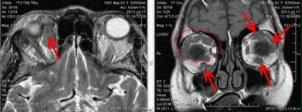 Mrt expert, мрт în diagnosticarea bolilor de orbite