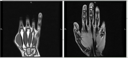 Prețul încheieturii încheieturii mâinii, face un diagnostic cu degetul
