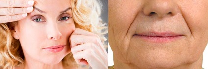 Care sunt ridurile de pe fața unei persoane diagnosticate?