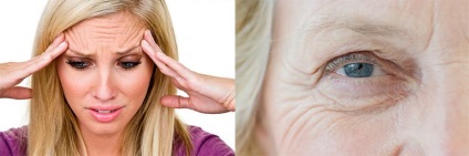 Care sunt ridurile de pe fața unei persoane diagnosticate?