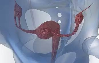 Omiterea (pierderea) cauzată de uter, principalele simptome, tratamentul și revizuirile asupra acestuia