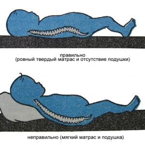Ortopéd matrac típusok, hogyan kell választani ortopéd matrac