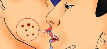 Ce cauzează herpesul pe buze 4 motive principale - linia de sănătate