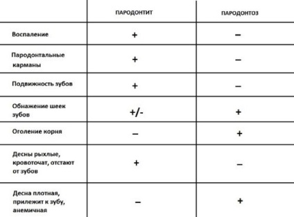 Parodontoza - simptome, cauze și prevenirea parodontozei gingivale - portal dentar