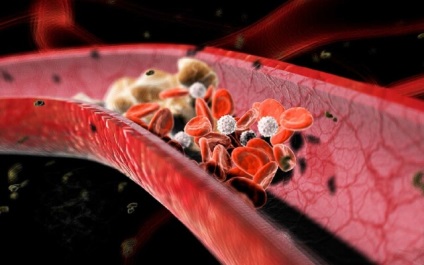 Cauzele colesterolului scăzut în sânge