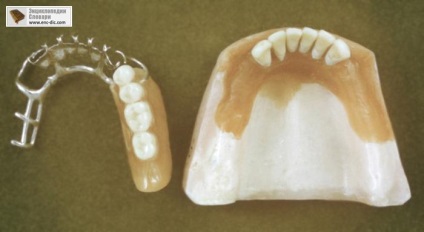 Протезування зубів - медична еціклопедія - енциклопедії & amp; словники