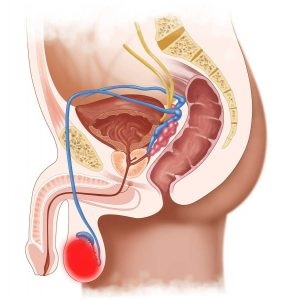 Simptomele cancerului testicular la bărbați