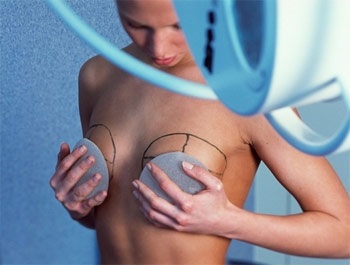 Siluri de sân plus și minus de proteze de sân