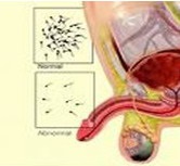 Spermograma, urologul meu