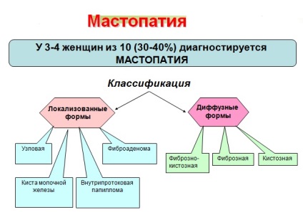 Спіраль при мастопатії можна ставити мирний і інші, чи може викликати спіраль мастопатію