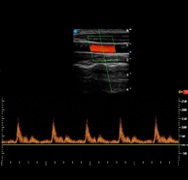 Aparat staționar de ultrasunete apogee 3800, siui (china)