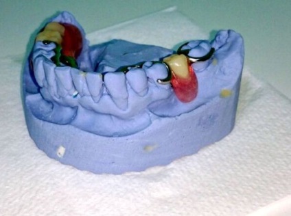 Servicii dentare de stomatologie - stomatologie posmishka 32