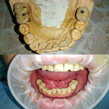 Servicii dentare de stomatologie - stomatologie posmishka 32