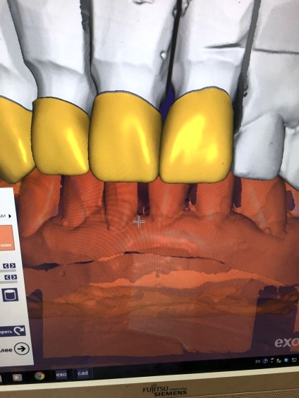 Servicii dentare de stomatologie - stomatologie posmishka 32