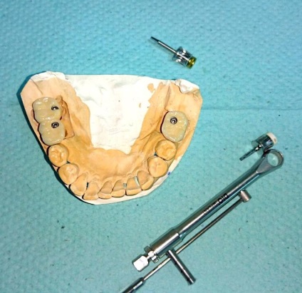 Servicii dentare de stomatologie - stomatologie posmishka 32