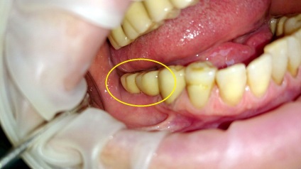 Servicii dentare de stomatologie - stomatologie posmishka 32