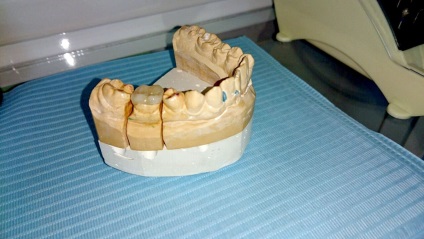 Servicii dentare de stomatologie - stomatologie posmishka 32