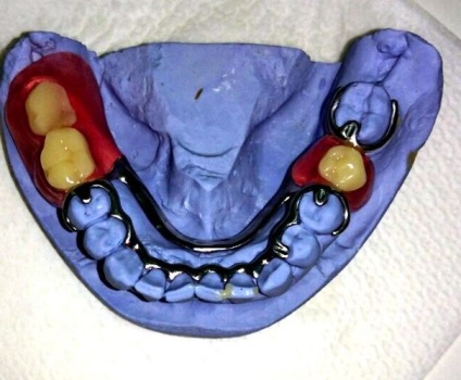 Servicii dentare de stomatologie - stomatologie posmishka 32