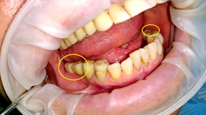 Servicii dentare de stomatologie - stomatologie posmishka 32