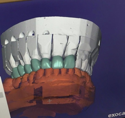 Servicii dentare de stomatologie - stomatologie posmishka 32