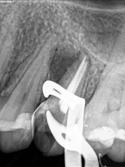 Servicii dentare de stomatologie - stomatologie posmishka 32