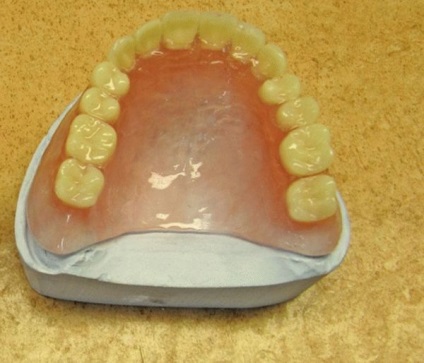 Термолітьевое пресування в стоматології - вибираємо термопрес, портал для фахівців