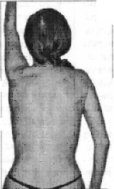 Gyakorlat gerincferdülés (scoliosis gyakorlatok) Gyakorlása scoliosis