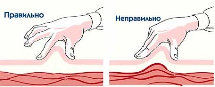 Injecții intramusculare