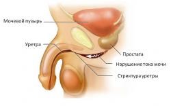 Питання чим небезпечний хламідіоз