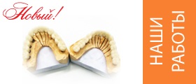 Питання і відповіді - стоматологія дентстайл