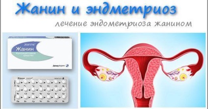 Câți ani se termină perioadele menstruale la femei - la ce vârstă se opresc