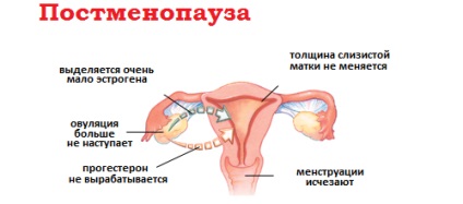 Câți ani se termină perioadele menstruale la femei - la ce vârstă se opresc