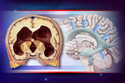 Neurolog neurolog neurolog neurolog neurolog neurolog neurochirurg ischemie ischemie a creierului