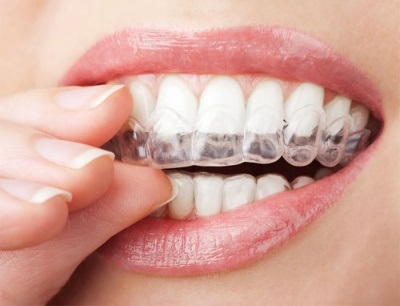 Dinți albi folosind curcumă