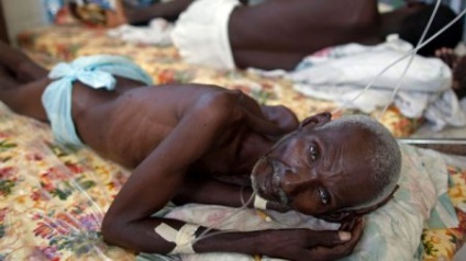Cholera - simptome și moduri de tratament