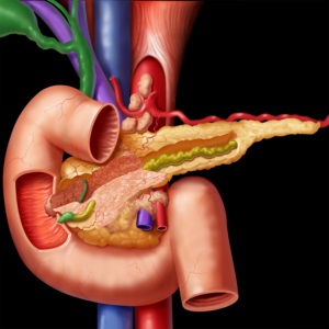 Allohol karsil pancreatitis, és ursosan kreon e Espumizan és hilak Forte, nátrium-tioszulfát