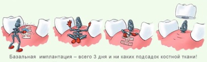 Implantarea dinților Boi
