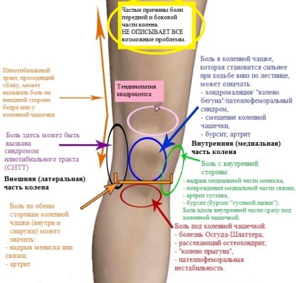 Genunchiul durează ce trebuie făcut sau făcut și la ce medic să se adreseze la dureri la genunchi