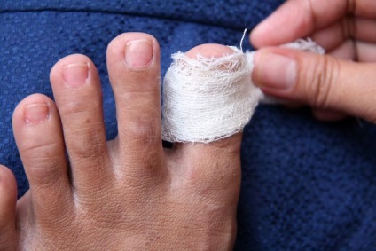 Болить палець на нозі - чому і що робити