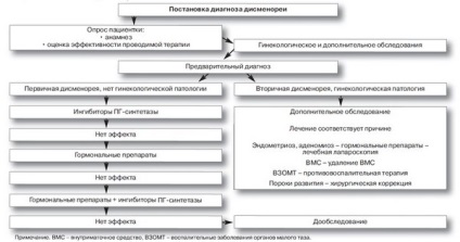 Дисменорея - причини, ознаки, симптоми і лікування